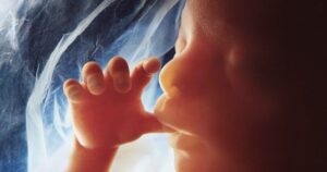 Poll: Supermajority of American Voters Oppose Abortion Past 12 Weeks