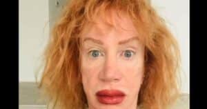 Trump Hater Kathy Griffin Unable to Speak After Latest Surgery