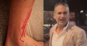 Millionaire Banker Jonathan Kaye Claims Self-Defense: Says He Was Assaulted and Hurled Anti-Semitic Slurs by Four ‘Queers for Palestine’ Protesters Before Viral Punching Incident